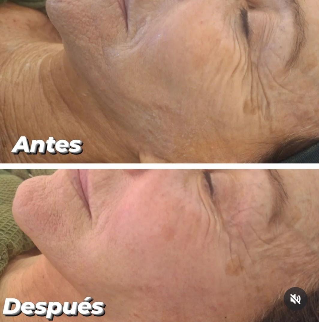 Tratamiento facial Kaizen Spa