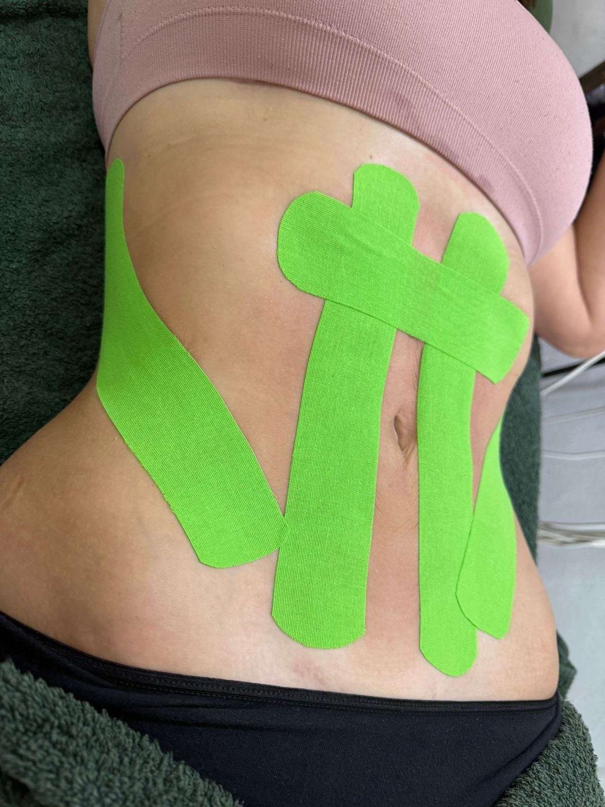 Kinesiotape