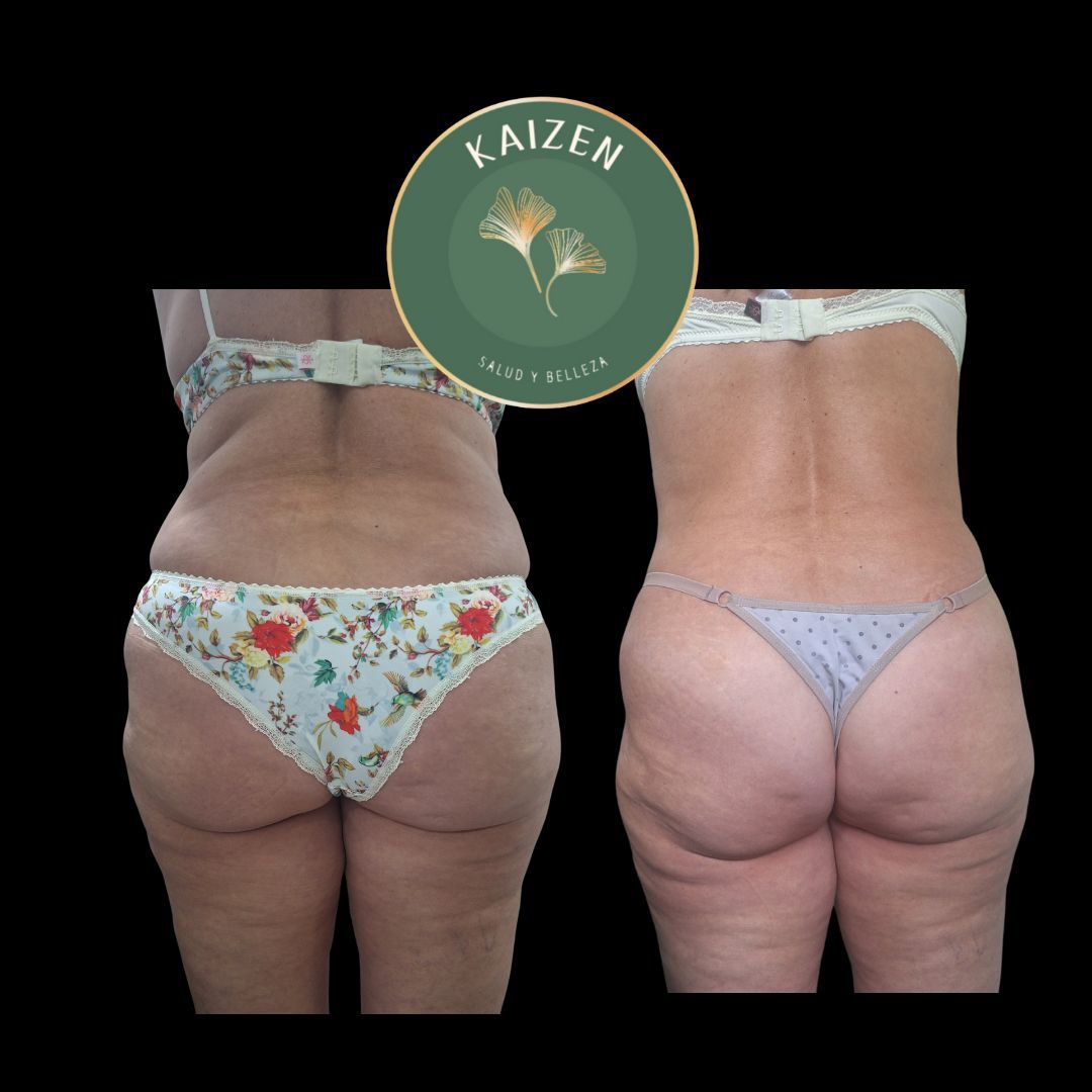 Tratamiento corporal Kaizen Spa