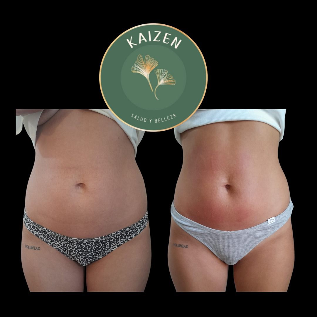 Drenaje y modelado corporal Kaizen Spa